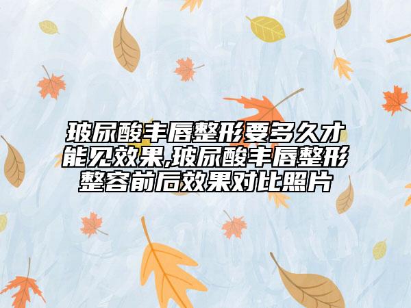 玻尿酸豐唇整形要多久才能見效果,玻尿酸豐唇整形整容前后效果對比照片