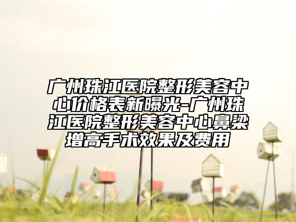 廣州珠江醫(yī)院整形美容中心價格表新曝光-廣州珠江醫(yī)院整形美容中心鼻梁增高手術效果及費用