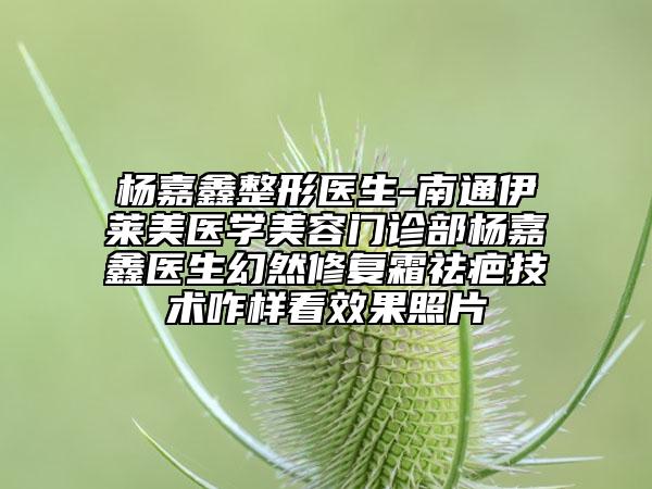 楊嘉鑫整形醫(yī)生-南通伊萊美醫(yī)學(xué)美容門診部楊嘉鑫醫(yī)生幻然修復(fù)霜祛疤技術(shù)咋樣看效果照片
