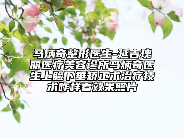 馬炳奇整形醫(yī)生-延吉瑰麗醫(yī)療美容診所馬炳奇醫(yī)生上瞼下垂矯正術治療技術咋樣看效果照片