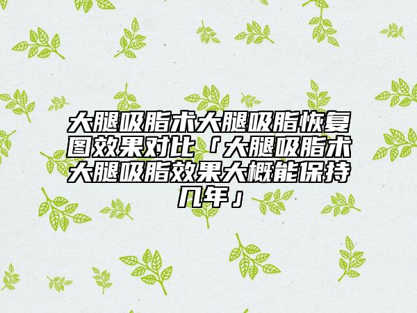 大腿吸脂術(shù)大腿吸脂恢復(fù)圖效果對比「大腿吸脂術(shù)大腿吸脂效果大概能保持幾年」
