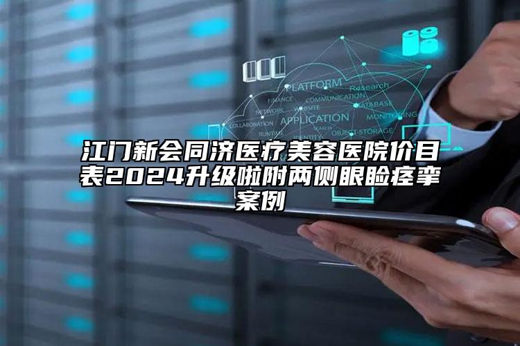 江門新會(huì)同濟(jì)醫(yī)療美容醫(yī)院價(jià)目表2024升級(jí)啦附兩側(cè)眼瞼痙攣案例