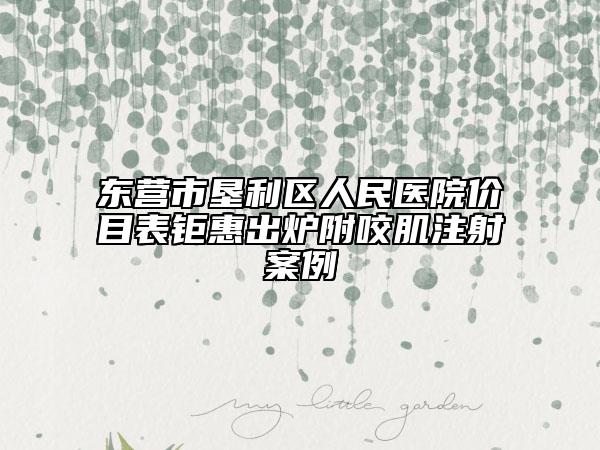 東營(yíng)市墾利區(qū)人民醫(yī)院價(jià)目表鉅惠出爐附咬肌注射案例
