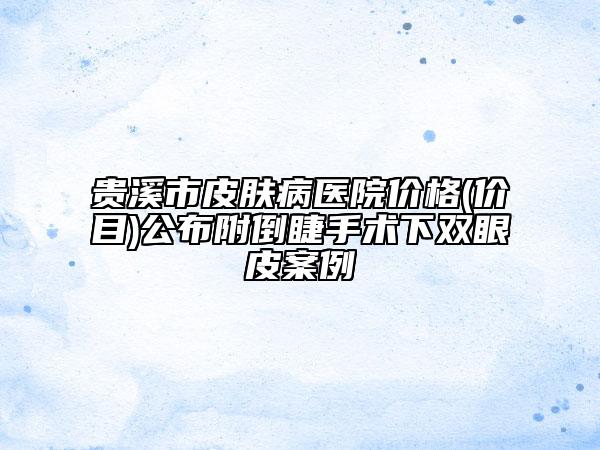 貴溪市皮膚病醫(yī)院價格(價目)公布附倒睫手術(shù)下雙眼皮案例