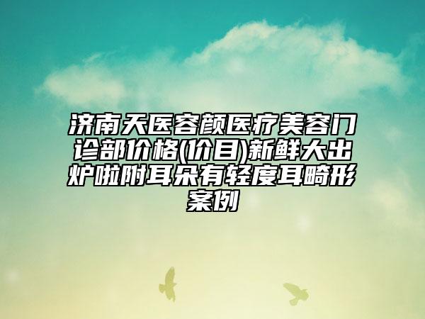 濟南天醫(yī)容顏醫(yī)療美容門診部價格(價目)新鮮大出爐啦附耳朵有輕度耳畸形案例