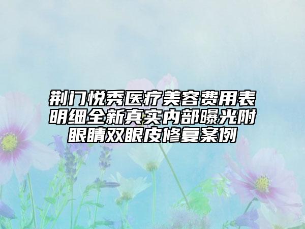 荊門(mén)悅秀醫(yī)療美容費(fèi)用表明細(xì)全新真實(shí)內(nèi)部曝光附眼睛雙眼皮修復(fù)案例