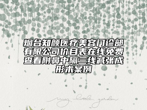 煙臺知顏醫(yī)療美容門診部有限公司價(jià)目表在線免費(fèi)查看附鼻中隔三線減張成形術(shù)案例