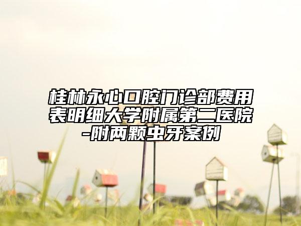 桂林永心口腔門診部費(fèi)用表明細(xì)大學(xué)附屬第二醫(yī)院-附兩顆蟲牙案例