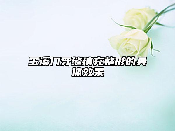 玉溪門牙縫填充整形的具體效果