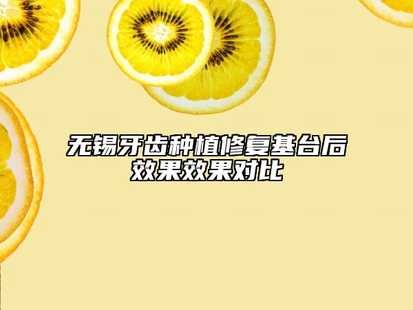 無錫牙齒種植修復(fù)基臺后效果效果對比