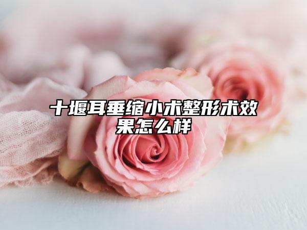 十堰耳垂縮小術(shù)整形術(shù)效果怎么樣