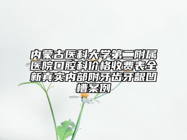 內(nèi)蒙古醫(yī)科大學(xué)第二附屬醫(yī)院口腔科價格收費表全新真實內(nèi)部附牙齒牙齦凹槽案例