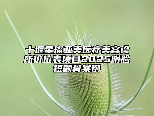 十堰星璨亞美醫(yī)療美容診所價(jià)位表項(xiàng)目2025附臉短顴骨案例