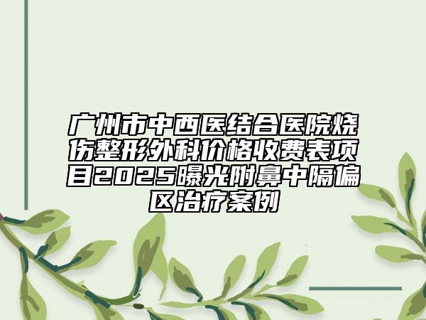 廣州市中西醫(yī)結(jié)合醫(yī)院燒傷整形外科價(jià)格收費(fèi)表項(xiàng)目2025曝光附鼻中隔偏區(qū)治療案例