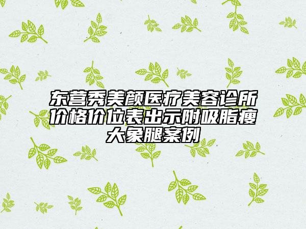 東營秀美顏醫(yī)療美容診所價格價位表出示附吸脂瘦大象腿案例