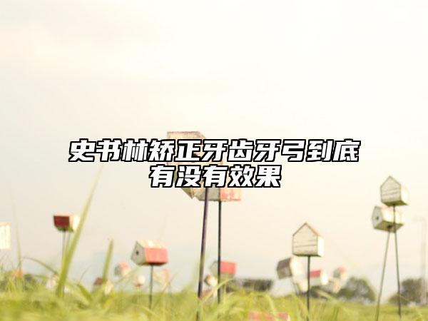 史書林矯正牙齒牙弓到底有沒有效果