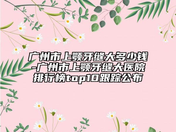 廣州市上顎牙縫大多少錢-廣州市上顎牙縫大醫(yī)院排行榜top10跟蹤公布