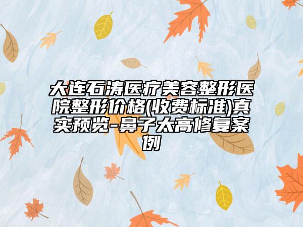 大連石濤醫(yī)療美容整形醫(yī)院整形價(jià)格(收費(fèi)標(biāo)準(zhǔn))真實(shí)預(yù)覽-鼻子太高修復(fù)案例