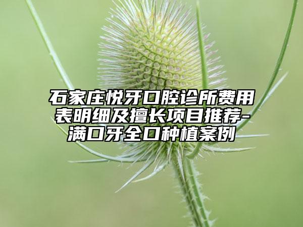 石家莊悅牙口腔診所費用表明細及擅長項目推薦-滿口牙全口種植案例