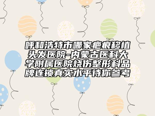 呼和浩特市哪家疤痕移植頭發(fā)醫(yī)院-內(nèi)蒙古醫(yī)科大學(xué)附屬醫(yī)院燒傷整形科品牌連鎖真實(shí)水平待你參考