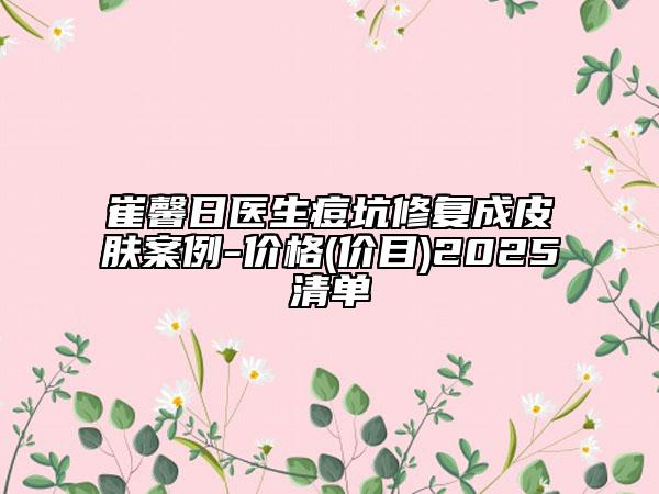 崔馨日醫(yī)生痘坑修復(fù)成皮膚案例-價(jià)格(價(jià)目)2025清單