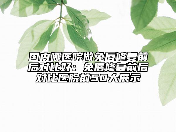 國內(nèi)哪醫(yī)院做兔唇修復(fù)前后對比好：兔唇修復(fù)前后對比醫(yī)院前50大展示