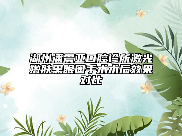 湖州潘震亞口腔診所激光嫩膚黑眼圈手術(shù)術(shù)后效果對(duì)比