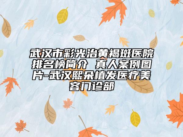 武漢市彩光治黃褐斑醫(yī)院排名榜簡介 真人案例圖片-武漢熙朵植發(fā)醫(yī)療美容門診部