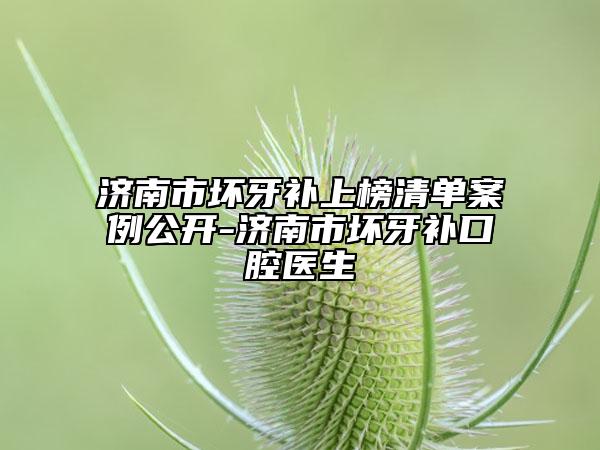 濟南市壞牙補上榜清單案例公開-濟南市壞牙補口腔醫(yī)生
