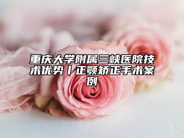 重慶大學(xué)附屬三峽醫(yī)院技術(shù)優(yōu)勢丨正顎矯正手術(shù)案例