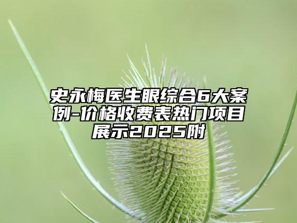 史永梅醫(yī)生眼綜合6大案例-價(jià)格收費(fèi)表熱門項(xiàng)目展示2025附