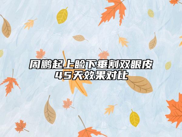 周鵬起上瞼下垂割雙眼皮45天效果對(duì)比