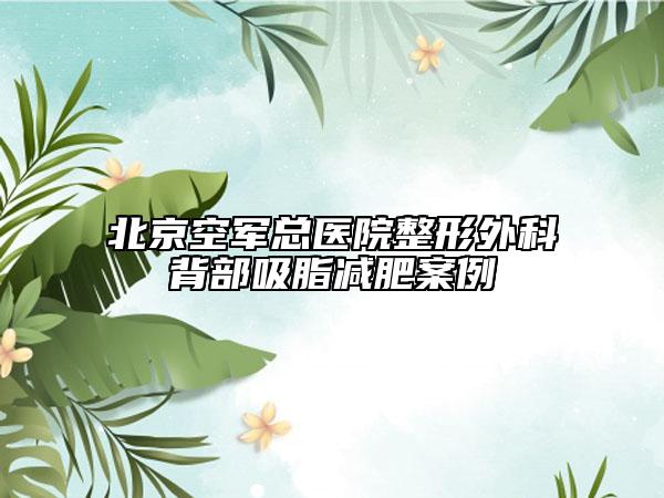北京空軍總醫(yī)院整形外科背部吸脂減肥案例
